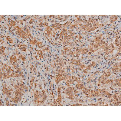 Phospho-Filamin A (Ser2152) Antibody in Immunohistochemistry (Paraffin) (IHC (P))