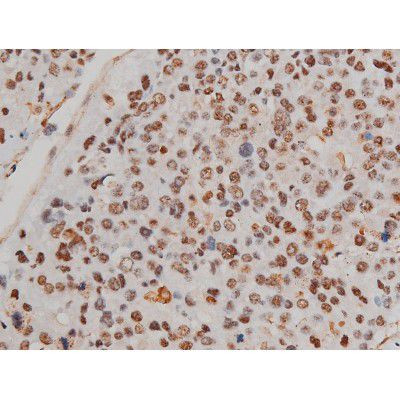 Phospho-Filamin A (Ser2152) Antibody in Immunohistochemistry (Paraffin) (IHC (P))