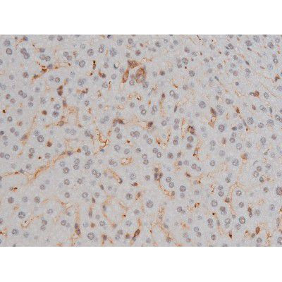 Phospho-Filamin A (Ser2152) Antibody in Immunohistochemistry (Paraffin) (IHC (P))