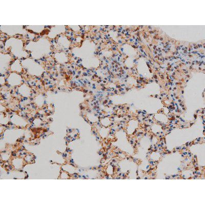 Phospho-Filamin A (Ser2152) Antibody in Immunohistochemistry (Paraffin) (IHC (P))