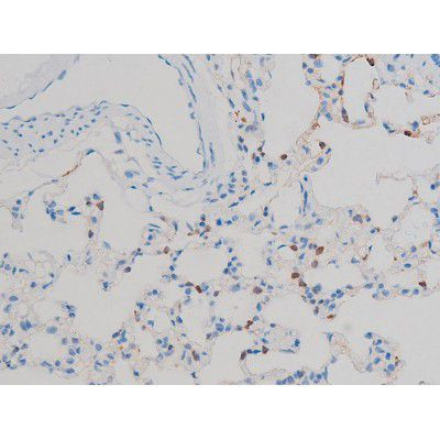 Phospho-p70 S6 Kinase (Ser371) Antibody in Immunohistochemistry (Paraffin) (IHC (P))