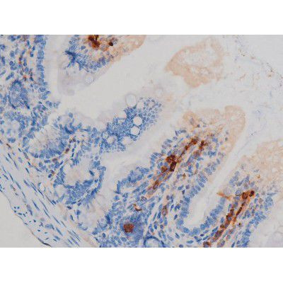 Phospho-p70 S6 Kinase (Ser371) Antibody in Immunohistochemistry (Paraffin) (IHC (P))