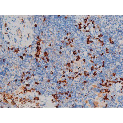 Phospho-p70 S6 Kinase (Ser371) Antibody in Immunohistochemistry (Paraffin) (IHC (P))