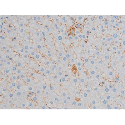 Phospho-p70 S6 Kinase (Ser371) Antibody in Immunohistochemistry (Paraffin) (IHC (P))