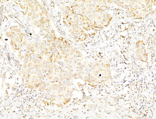 Phospho-p70 S6 Kinase (Thr389, Thr412) Antibody in Immunohistochemistry (Paraffin) (IHC (P))