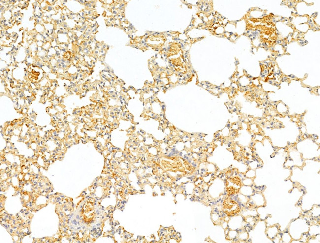 Phospho-p70 S6 Kinase (Thr389, Thr412) Antibody in Immunohistochemistry (Paraffin) (IHC (P))