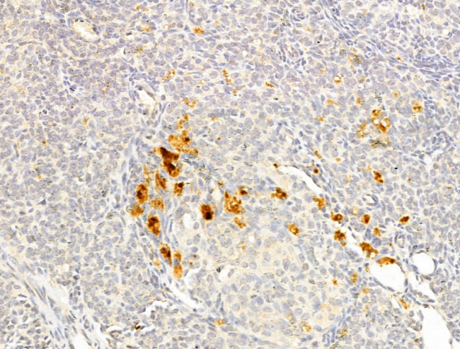 Phospho-p70 S6 Kinase (Thr389, Thr412) Antibody in Immunohistochemistry (Paraffin) (IHC (P))