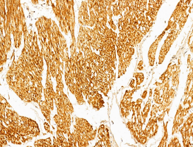 Phospho-p70 S6 Kinase (Thr389, Thr412) Antibody in Immunohistochemistry (Paraffin) (IHC (P))