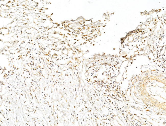 Phospho-p70 S6 Kinase (Thr389, Thr412) Antibody in Immunohistochemistry (Paraffin) (IHC (P))