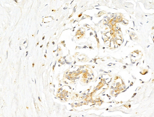 Phospho-p70 S6 Kinase (Thr389, Thr412) Antibody in Immunohistochemistry (Paraffin) (IHC (P))