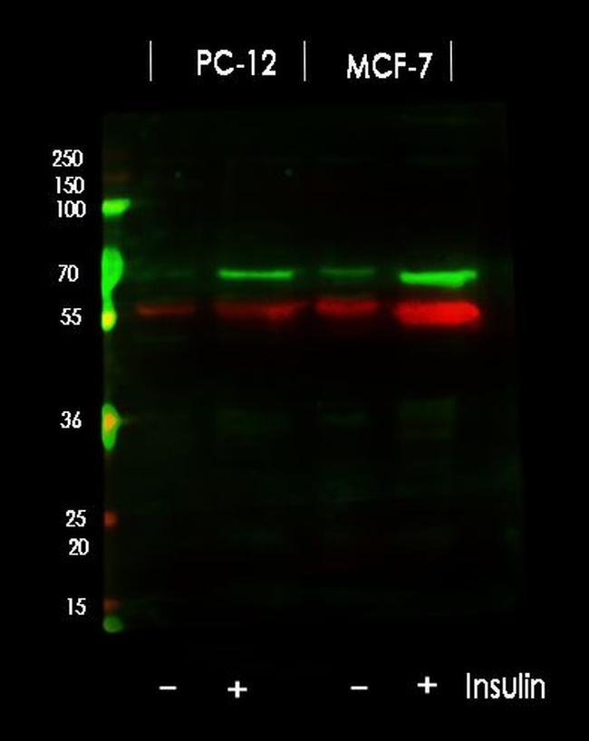 Phospho-p70 S6 Kinase (Thr389, Thr412) Antibody in Western Blot (WB)