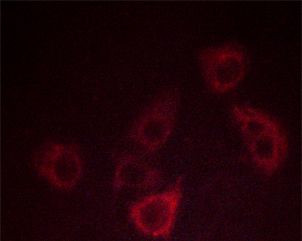 Phospho-CXCR2 (Ser347) Antibody in Immunocytochemistry (ICC/IF)