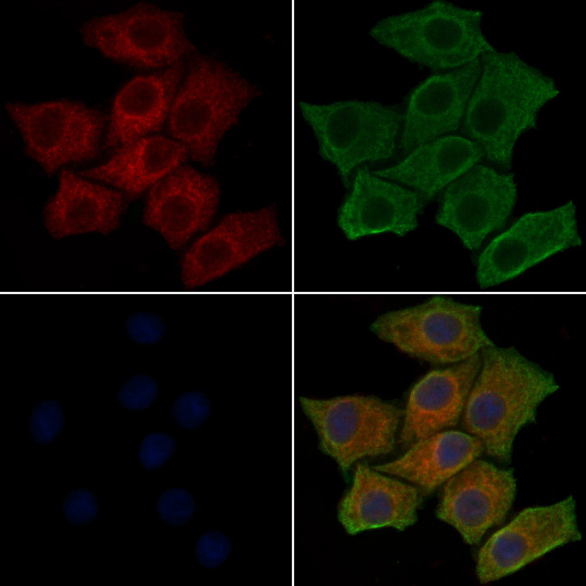 Phospho-PI3K p85 alpha (Tyr607) Antibody in Immunocytochemistry (ICC/IF)