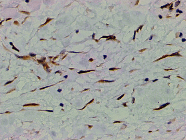 Phospho-PI3K p85 alpha (Tyr607) Antibody in Immunohistochemistry (Paraffin) (IHC (P))