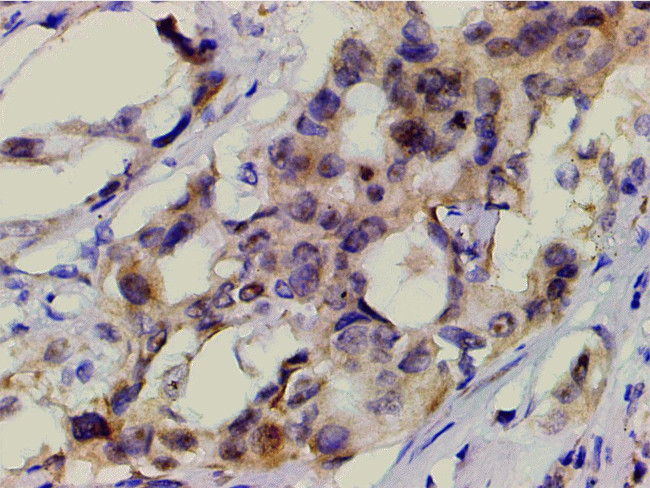 Phospho-PI3K p85 alpha (Tyr607) Antibody in Immunohistochemistry (Paraffin) (IHC (P))