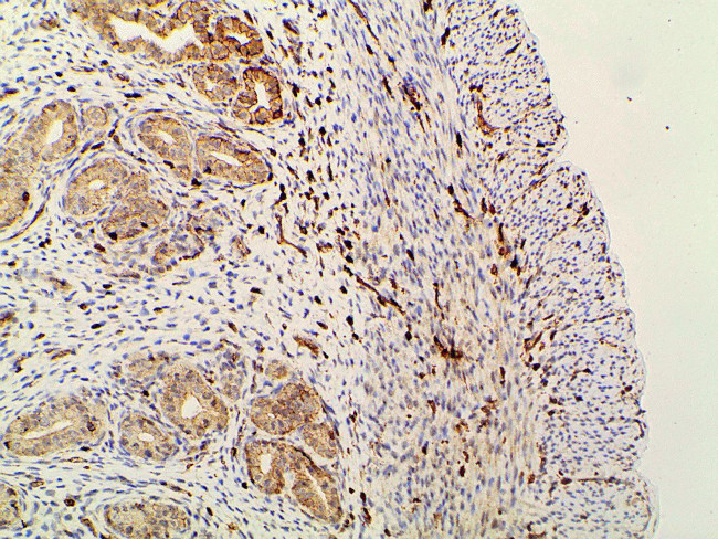 Phospho-PI3K p85 alpha (Tyr607) Antibody in Immunohistochemistry (Paraffin) (IHC (P))