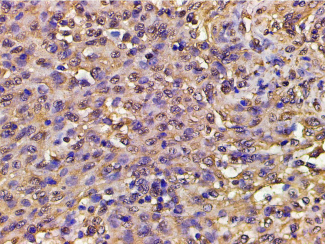 Phospho-PI3K p85 alpha (Tyr607) Antibody in Immunohistochemistry (Paraffin) (IHC (P))