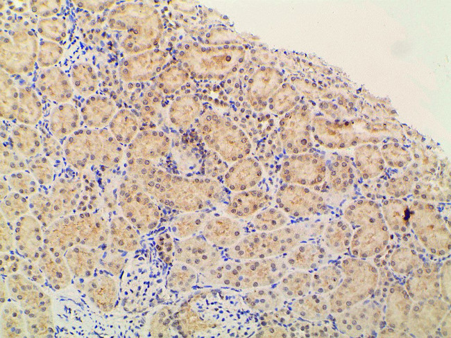 Phospho-PI3K p85 alpha (Tyr607) Antibody in Immunohistochemistry (Paraffin) (IHC (P))