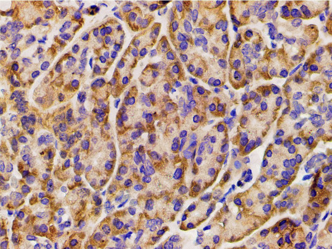 Phospho-PI3K p85 alpha (Tyr607) Antibody in Immunohistochemistry (Paraffin) (IHC (P))