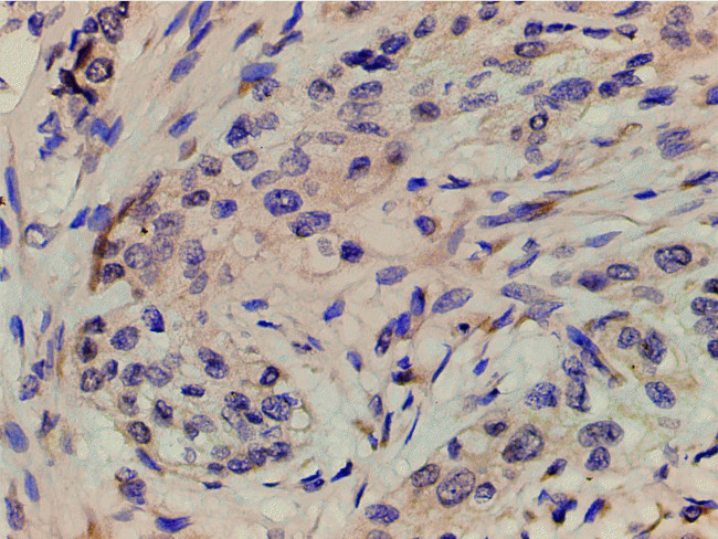 Phospho-PI3K p85 alpha (Tyr607) Antibody in Immunohistochemistry (Paraffin) (IHC (P))