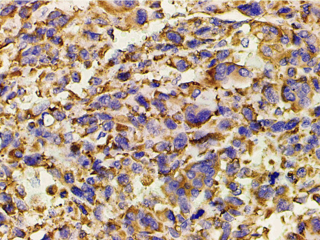 Phospho-PI3K p85 alpha (Tyr607) Antibody in Immunohistochemistry (Paraffin) (IHC (P))