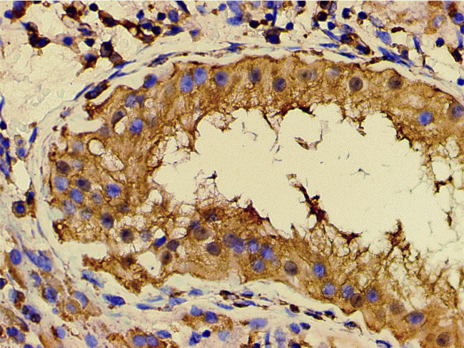 Phospho-PI3K p85 alpha (Tyr607) Antibody in Immunohistochemistry (Paraffin) (IHC (P))