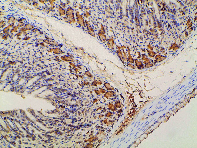 Phospho-PI3K p85 alpha (Tyr607) Antibody in Immunohistochemistry (Paraffin) (IHC (P))