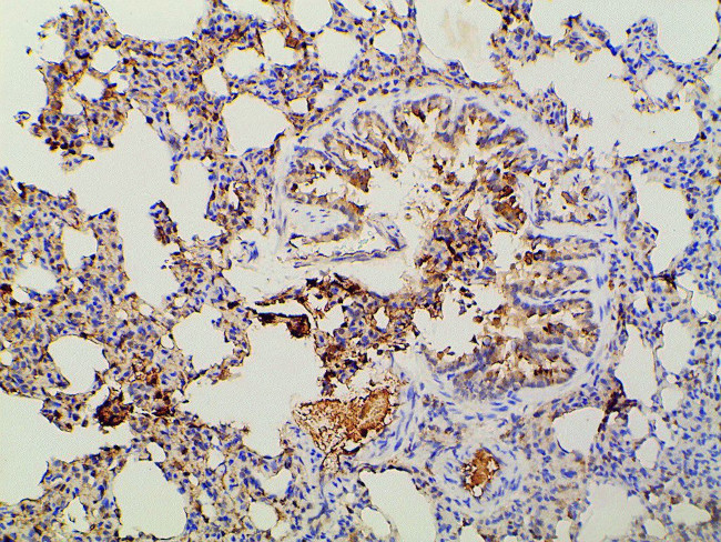 Phospho-PI3K p85 alpha (Tyr607) Antibody in Immunohistochemistry (Paraffin) (IHC (P))