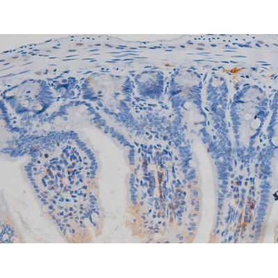 Phospho-eNOS (Ser1177) Antibody in Immunohistochemistry (Paraffin) (IHC (P))