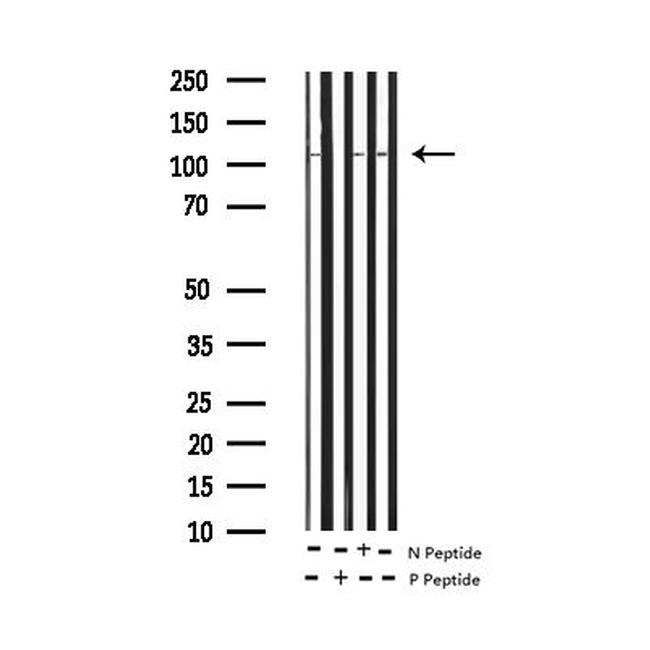 Phospho-eNOS (Ser1177) Antibody in Western Blot (WB)