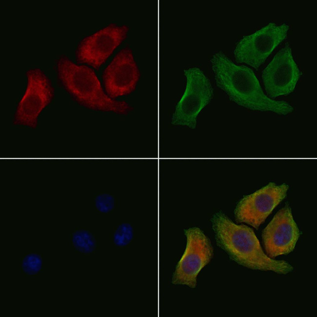 Phospho-nNOS (Ser852) Antibody in Immunocytochemistry (ICC/IF)