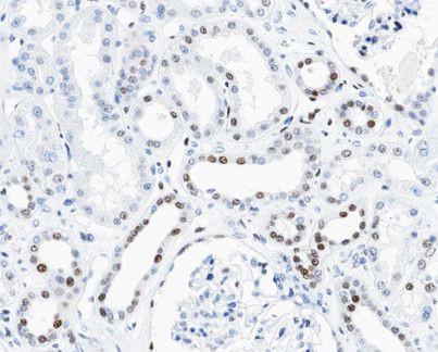 Phospho-Cyclin D3 (Thr283) Antibody in Immunohistochemistry (Paraffin) (IHC (P))