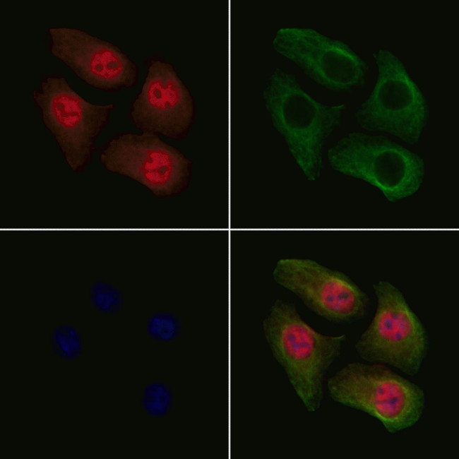 Phospho-Cdc25A (Ser178) Antibody in Immunocytochemistry (ICC/IF)