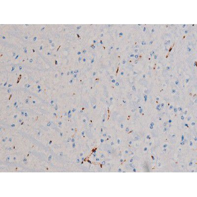 Phospho-Cdc25A (Ser178) Antibody in Immunohistochemistry (Paraffin) (IHC (P))