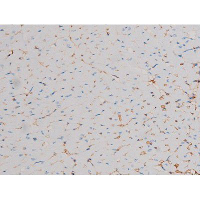 Phospho-Cdc25A (Ser178) Antibody in Immunohistochemistry (Paraffin) (IHC (P))