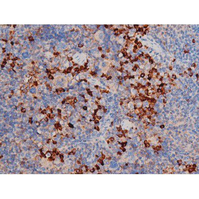 Phospho-Cdc25A (Ser178) Antibody in Immunohistochemistry (Paraffin) (IHC (P))