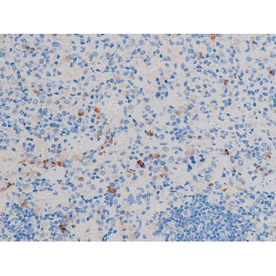 Phospho-Cdc25A (Ser178) Antibody in Immunohistochemistry (Paraffin) (IHC (P))