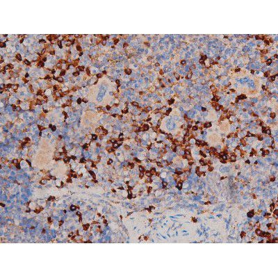 Phospho-Cdc25A (Ser178) Antibody in Immunohistochemistry (Paraffin) (IHC (P))