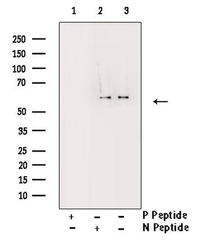 Phospho-Cdc25A (Ser178) Antibody in Western Blot (WB)