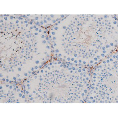 Phospho-CDC25B (Ser323) Antibody in Immunohistochemistry (Paraffin) (IHC (P))