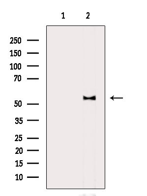 Phospho-AKT1 (Thr450) Antibody in Western Blot (WB)