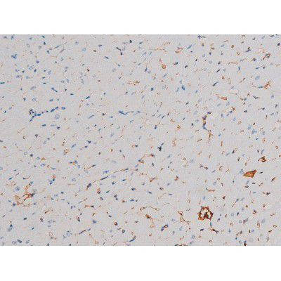 Phospho-AKT1 (Thr450) Antibody in Immunohistochemistry (Paraffin) (IHC (P))