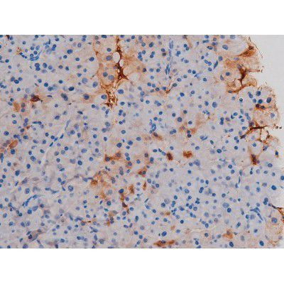 Phospho-AKT1 (Thr450) Antibody in Immunohistochemistry (Paraffin) (IHC (P))