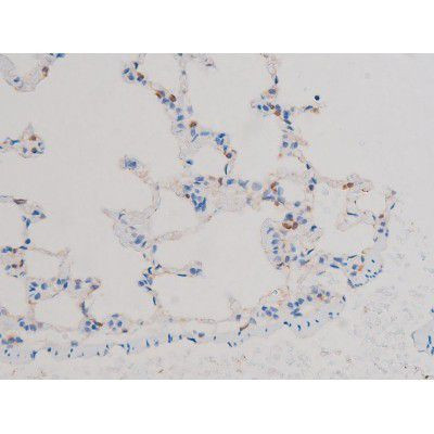 Phospho-AKT1 (Thr450) Antibody in Immunohistochemistry (Paraffin) (IHC (P))