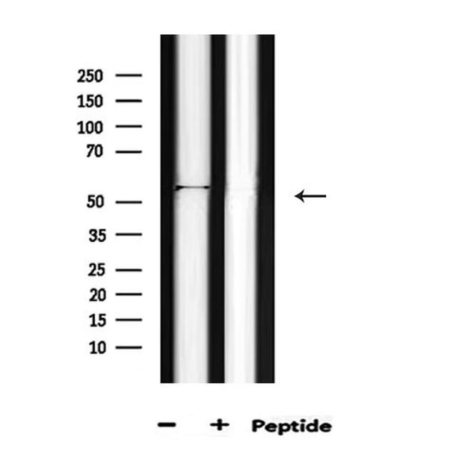 Phospho-AKT1 (Thr450) Antibody in Western Blot (WB)