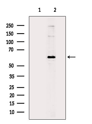 Phospho-AKT1 (Ser124) Antibody in Western Blot (WB)