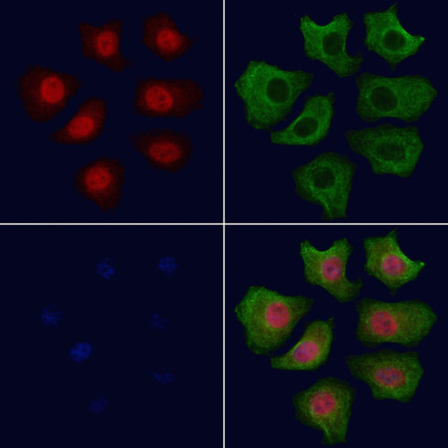 Phospho-AKT1 (Ser124) Antibody in Immunocytochemistry (ICC/IF)