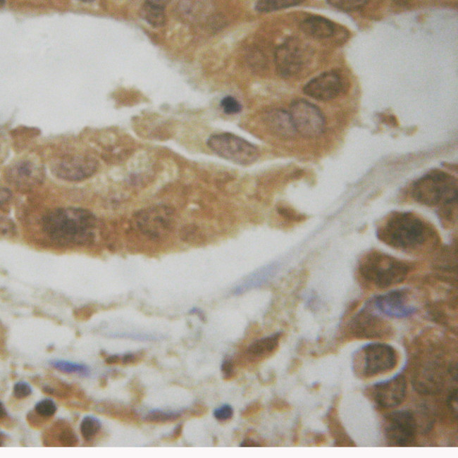 Phospho-AKT1 (Ser124) Antibody in Immunohistochemistry (Paraffin) (IHC (P))