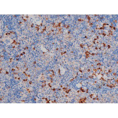 Phospho-AKT1 (Ser124) Antibody in Immunohistochemistry (Paraffin) (IHC (P))