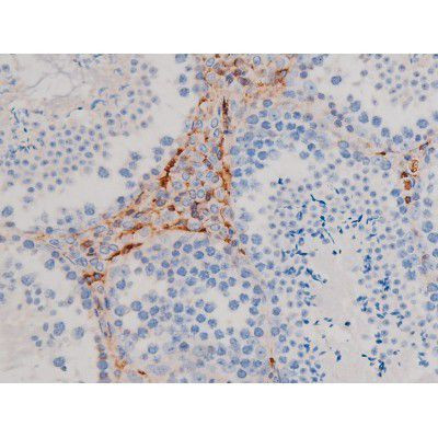 Phospho-AKT1 (Ser124) Antibody in Immunohistochemistry (Paraffin) (IHC (P))